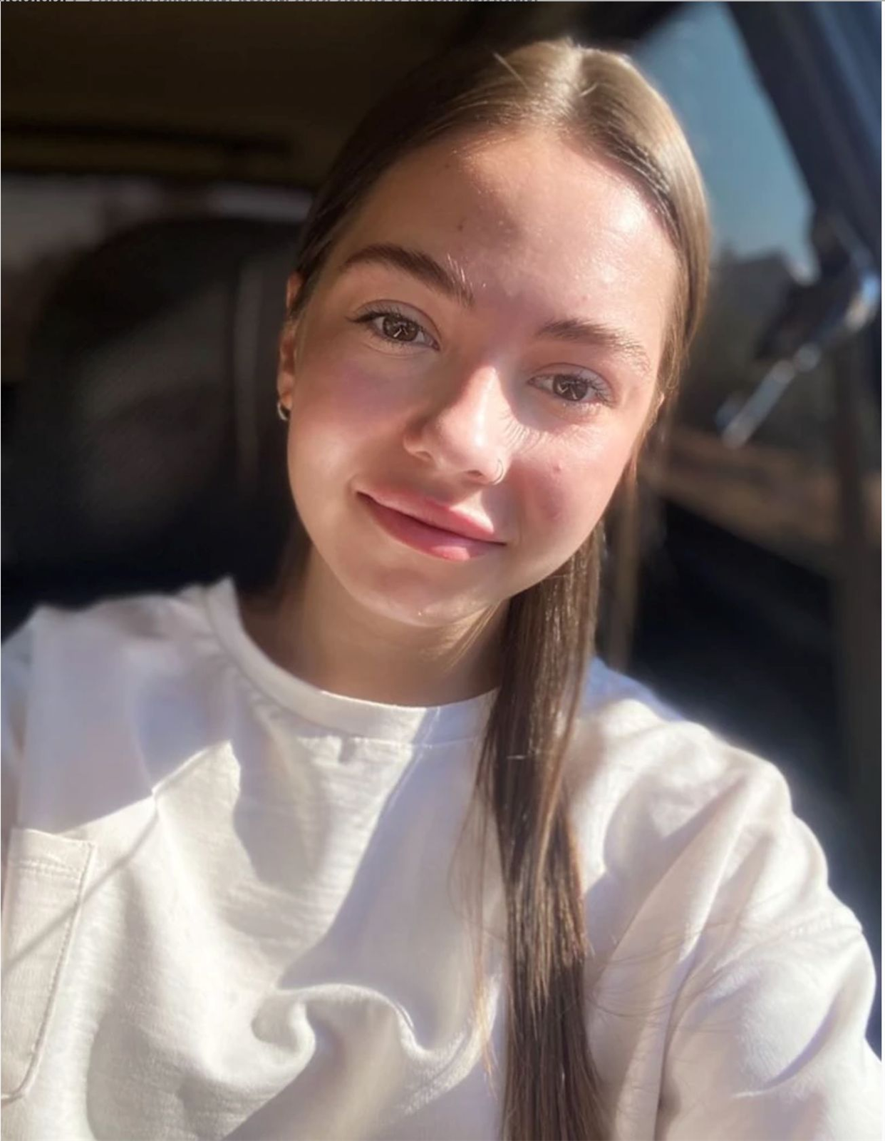Результат ухода после